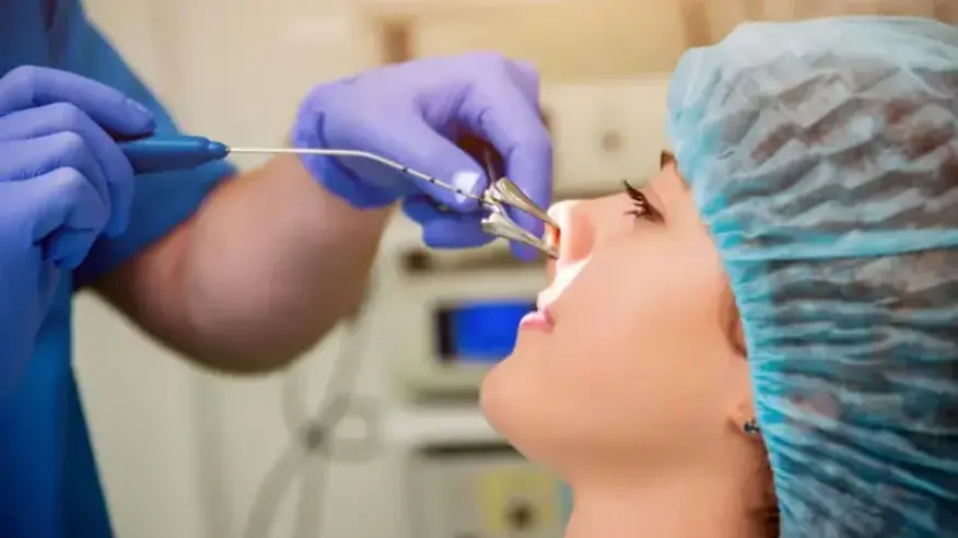 Konchoplastyka Wrocław